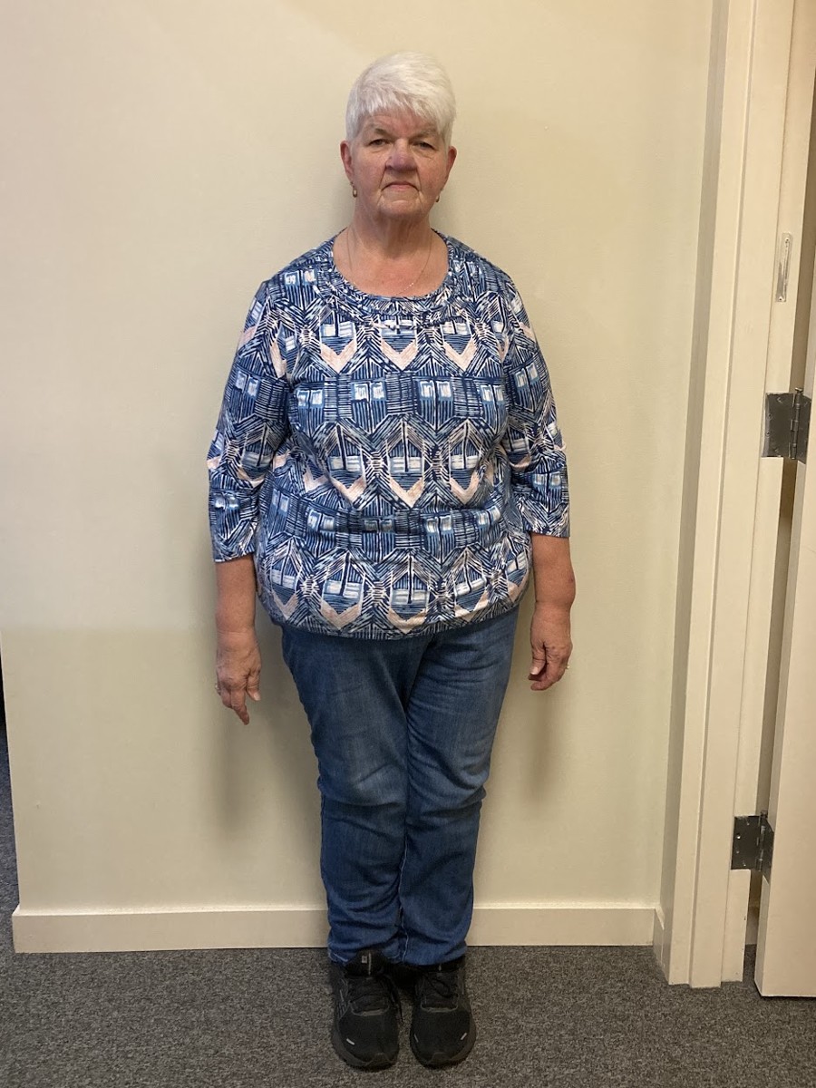 Michele R before PHD Weight Loss