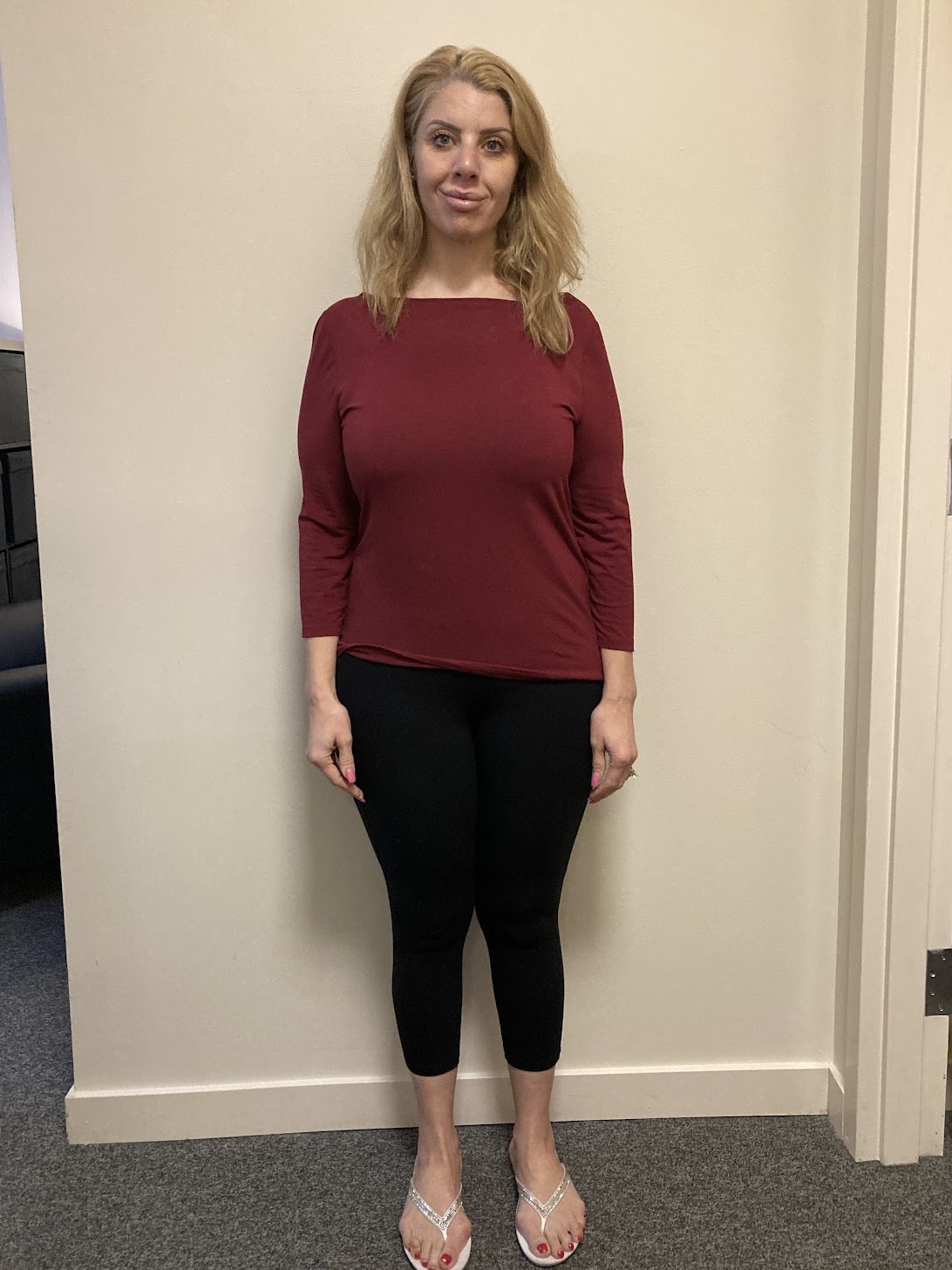 Iris after PHD Weight Loss, Down 53.2 lbs in 20 weeks