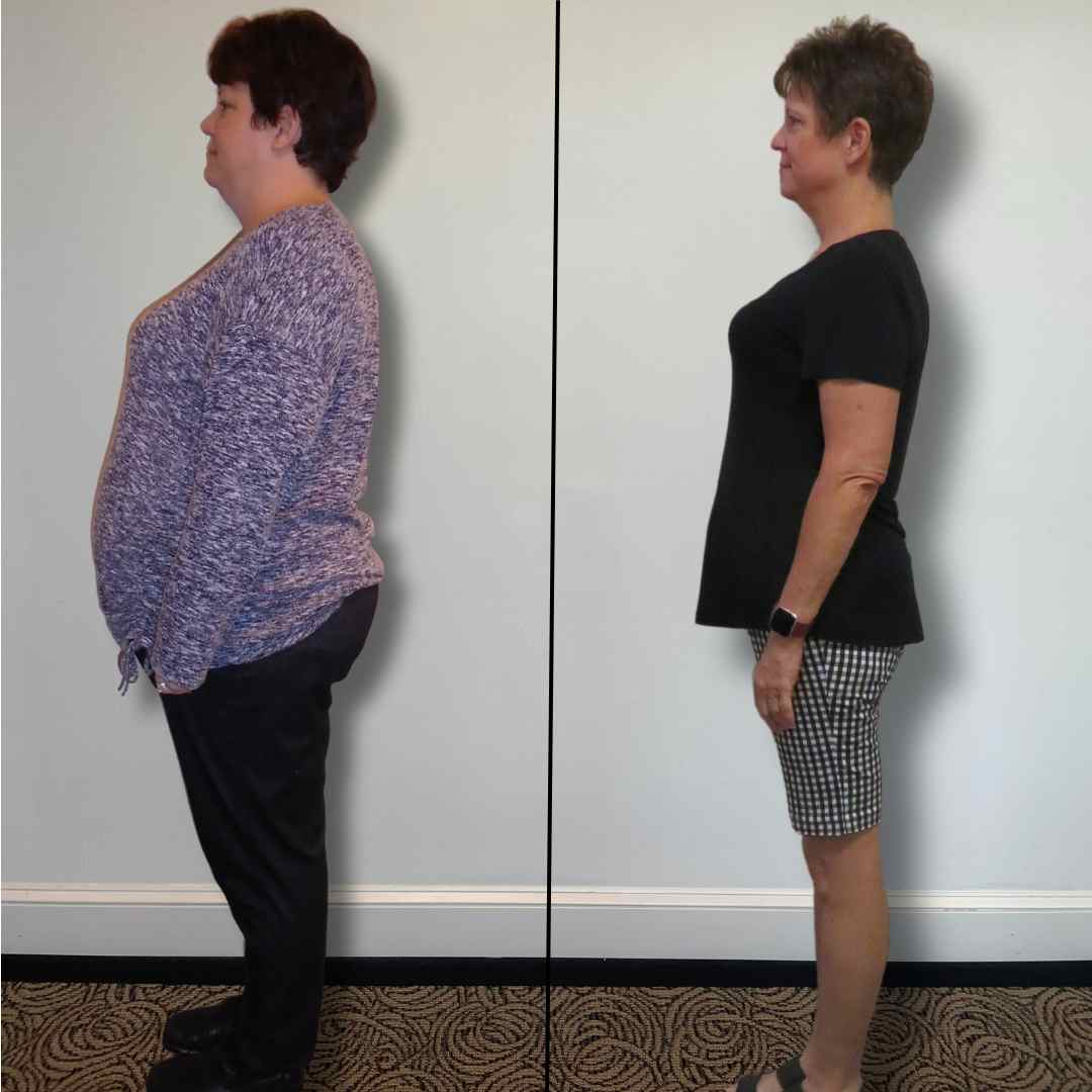 Christina before and after PHD Weight Loss, Down 97 lbs